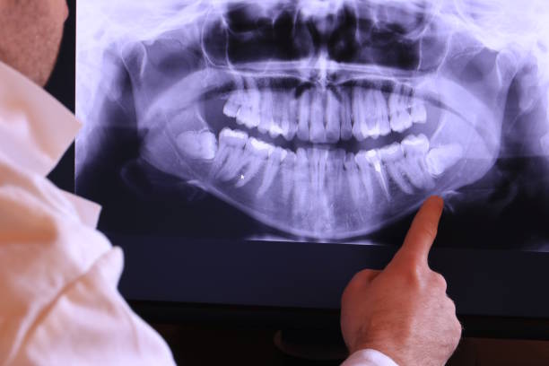 Best Emergency Dentist for Knocked-Out Tooth in Walnut, IL