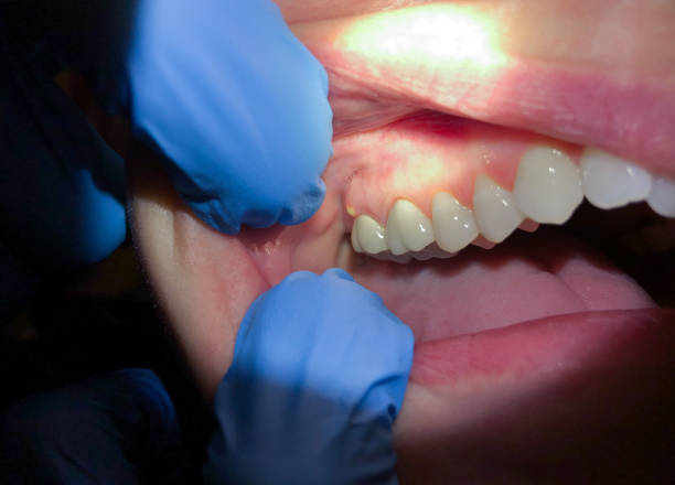 Best Pediatric Emergency Dentist in Walnut, IL