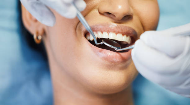 Best Emergency Root Canal Treatment in Walnut, IL